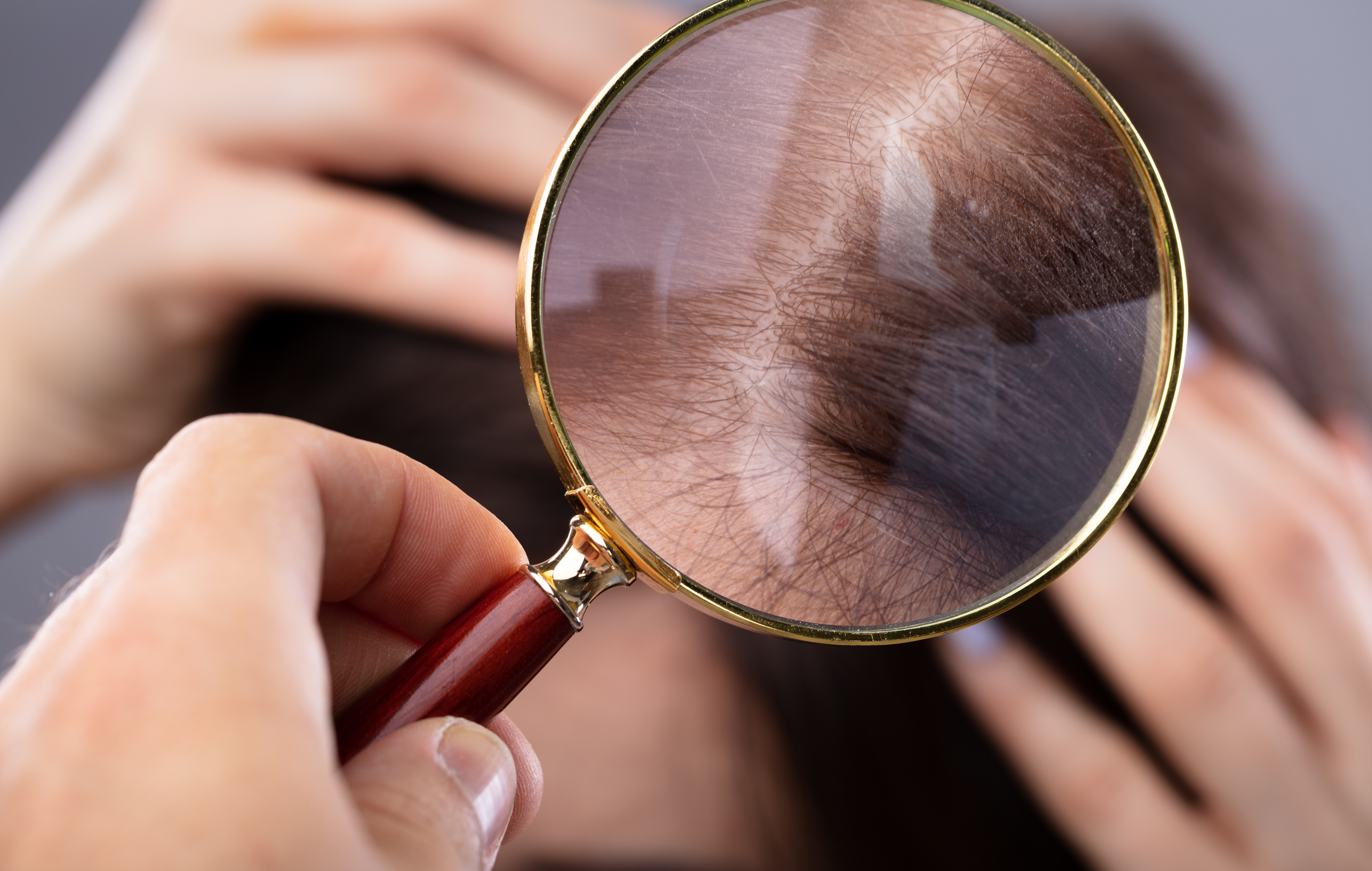 Haarwachstum - kann man das Wachsen der Haare beeinflussen?